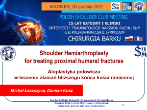 Shoulder Hemiarthroplasty for treating proximal humeral fractures