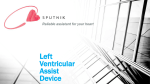 Left Ventricular Assist Device Reliable assistant for your heart