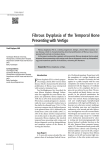 Fibrous Dysplasia of the Temporal Bone Presenting with Vertigo