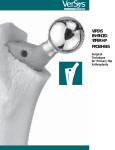 versys enhanced taper hip prosthesis