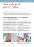 Transpedal Arterial Access in Practice