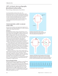 ABC of clinical electrocardiography Junctional tachycardias