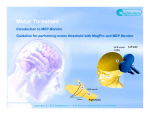 Motor Threshold - McCausland Center For Brain Imaging