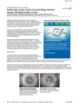 Endoscopic probe assists in performing cataract