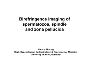 Birefringence imaging of spermatozoa, spindle and zona pellucida