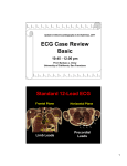 ECG Case Review