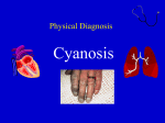 Cyanosis