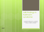 MRI findings in Kallmann syndrome