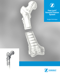 Free-Lock® Femoral Fixation System Surgical
