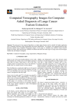 Computed Tomography Images for Computer Aided Diagnosis of