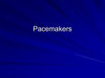 Pacemakers - 123seminarsonly.com