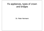 Fix appliances, types of crown and bridges Fix appliances, types of
