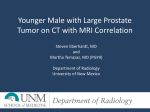 Prostate lesion on CT - Society of Abdominal Radiology