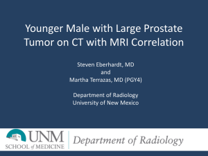 Prostate lesion on CT - Society of Abdominal Radiology