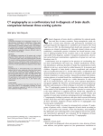 CT angiography as a confirmatory test in diagnosis of brain death