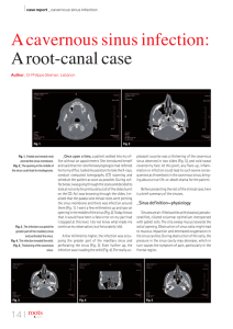 A cavernous sinus infection: A root-canal case