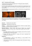 Case 4 Inflammatory optic neuropathy A 59-year