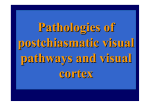 Pathologies of postchiasmatic visual pathways and visual cortex