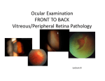 Ocular Examination FRONT TO BACK Vitreous/Peripheral Retina