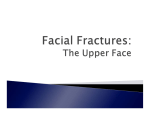 Facial Fractures: The Upper Face