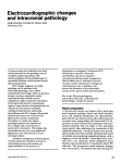 Electrocardiographic changes and intracranial pathology