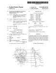 System and method of AV interval selection in an implantable