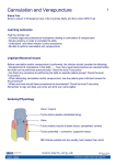 Cannulation and Venepuncture