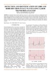 detection and identification of lbbb and rbbb rhythms in ecg waves
