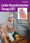 Cardiac Resynchronization Therapy (CRT)