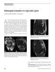 Radiological evaluation of a high ankle sprain