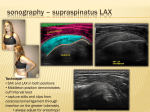 sonography – supraspinatus LAX