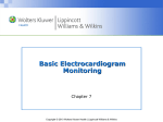 Chapter 7 Basic ECG Monitoring