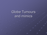 Globe tumours and mimics