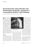 Sternoclavicular Joint Infection and Mediastinitis Originally Attributed