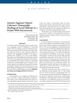 Anterior Segment Optical Coherence Tomography Findings of Acute