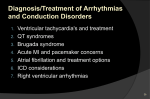 Acute Myocardial Infarction Gusto