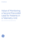 Value of Monitoring a Second Precordial Lead for