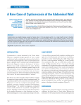 A Rare Case of Cysticercosis of the Abdominal Wall
