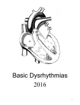 Basic Dysrhythmia Study Guide