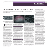 TRAnS-SCLERAL OUTFLOW
