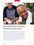 Whole Body MR for Visualizing Metastatic Prostate Cancer PDF