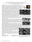 High-Resolution Imaging of the Laryngeal Cartilages