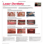 Laser Dentistry