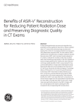Benefits of ASiR-V* Reconstruction for Reducing