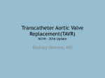 Transcatheter Aortic Valve Replacement(TAVR)