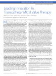 Leading Innovation in Transcatheter Mitral Valve Therapy
