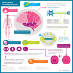 Brain matters in multiple sclerosis