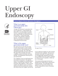 Upper GI Endoscopy - Mobile Gastroenterology, PC