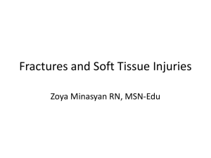 Focus on Fractures