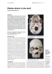 Median defect in the skull